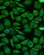 NDUFB3 Polyclonal Antibody