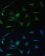 p38 MAPK alpha Polyclonal Antibody