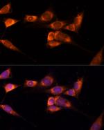 TXNDC12 Polyclonal Antibody