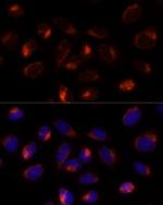 TXNDC12 Antibody in Immunocytochemistry (ICC/IF)
