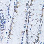 Carbonic Anhydrase XIII Antibody in Immunohistochemistry (Paraffin) (IHC (P))