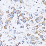 Carbonic Anhydrase XIII Polyclonal Antibody