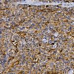 CD26 Polyclonal Antibody