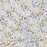 RPS27A Antibody in Immunohistochemistry (Paraffin) (IHC (P))