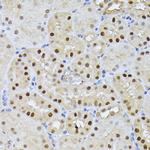 RPS27A Antibody in Immunohistochemistry (Paraffin) (IHC (P))