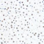 SP1 Antibody in Immunohistochemistry (Paraffin) (IHC (P))