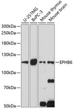 EphB6 Polyclonal Antibody