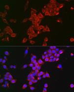 FSHR Polyclonal Antibody