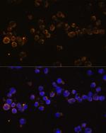 KLRC4 Polyclonal Antibody