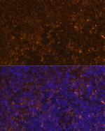 KLRC4 Antibody in Immunohistochemistry (Paraffin) (IHC (P))