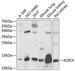 KLRC4 Antibody in Western Blot (WB)