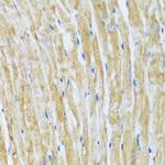 BAG3 Polyclonal Antibody