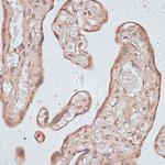 TLK1 Polyclonal Antibody