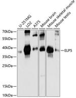 C17orf81 Antibody in Western Blot (WB)