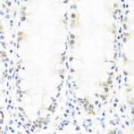 BRMS1 Antibody in Immunohistochemistry (Paraffin) (IHC (P))