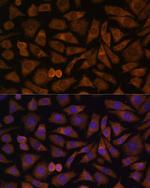 RABIF Polyclonal Antibody