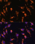 SSTR2 Antibody in Immunocytochemistry (ICC/IF)