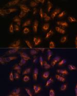 SSTR2 Polyclonal Antibody