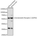 SSTR2 Antibody in Western Blot (WB)