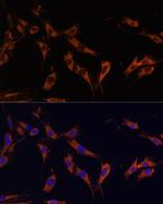 KSR1 Polyclonal Antibody