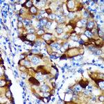 ABCF3 Antibody in Immunohistochemistry (Paraffin) (IHC (P))