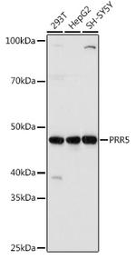 PRR5 Antibody in Western Blot (WB)