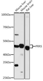 PRR5 Antibody in Western Blot (WB)