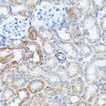 Kir4.2 (KCNJ15) Antibody in Immunohistochemistry (Paraffin) (IHC (P))