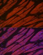 MYH2 Polyclonal Antibody