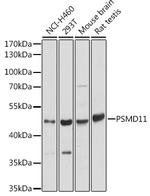 PSMD11 Polyclonal Antibody