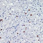 S100A8 Antibody in Immunohistochemistry (Paraffin) (IHC (P))