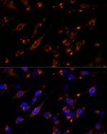 PTP4A2 Polyclonal Antibody