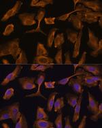 MTMR4 Polyclonal Antibody