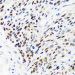 WDHD1 Antibody in Immunohistochemistry (Paraffin) (IHC (P))