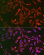 TNFR1 Polyclonal Antibody