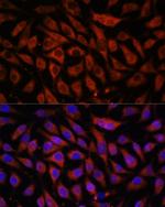 STK38L Polyclonal Antibody