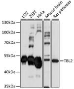 TBL2 Polyclonal Antibody