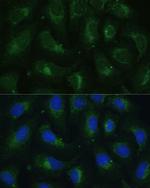 SULT1C4 Antibody in Immunocytochemistry (ICC/IF)
