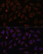 VILL Polyclonal Antibody