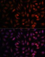 DDX24 Antibody in Immunocytochemistry (ICC/IF)