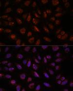 DDX24 Polyclonal Antibody