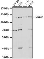 DDX24 Antibody in Western Blot (WB)