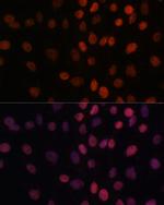 ARID1B Antibody in Immunocytochemistry (ICC/IF)
