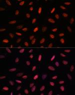 ARID1B Polyclonal Antibody