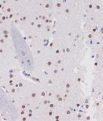 ARID1B Antibody in Immunohistochemistry (Paraffin) (IHC (P))
