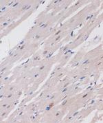 ARID1B Antibody in Immunohistochemistry (Paraffin) (IHC (P))