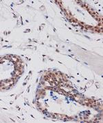 ARID1B Antibody in Immunohistochemistry (Paraffin) (IHC (P))