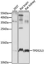 TPD52L3 Antibody in Western Blot (WB)