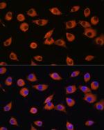 DNER Antibody in Immunocytochemistry (ICC/IF)
