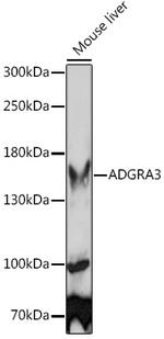 GPR125 Polyclonal Antibody